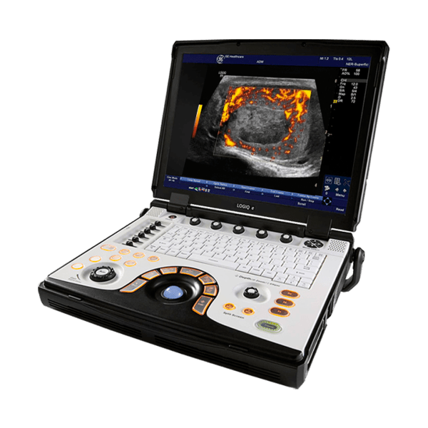 Imagen de un equipo de ultrasonido Logiq E de GE HealthCare, una avanzada tecnología médica para diagnóstico por imágenes.